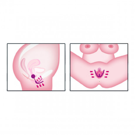 Тренажер Кегеля для тренировки интимных мышц Intimate Spreader Pussy Gym